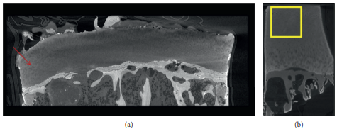 Contrast-Enhanced Micro-CT for Virtual 3D Anatomical Pathology of Biological Tissues: A Literature Review